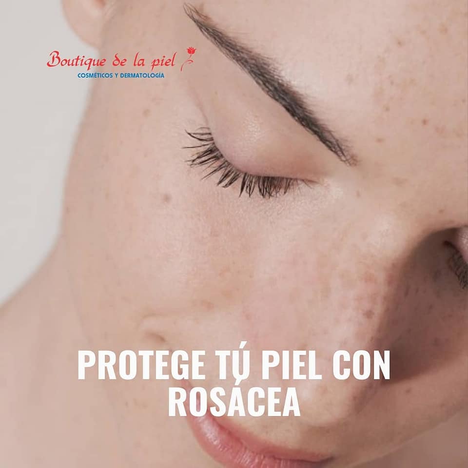rosacea