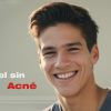 Acné